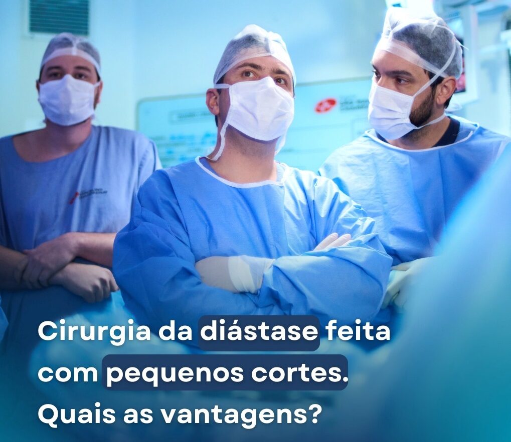 Cirurgia de diástase feita com pequenos cortes. Quais as vantagens?
