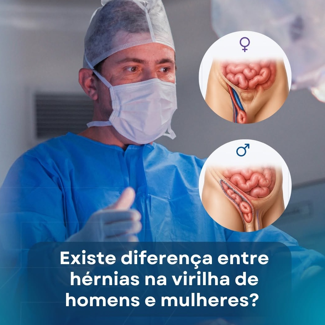 hernia inguinal, hérnia na virilha