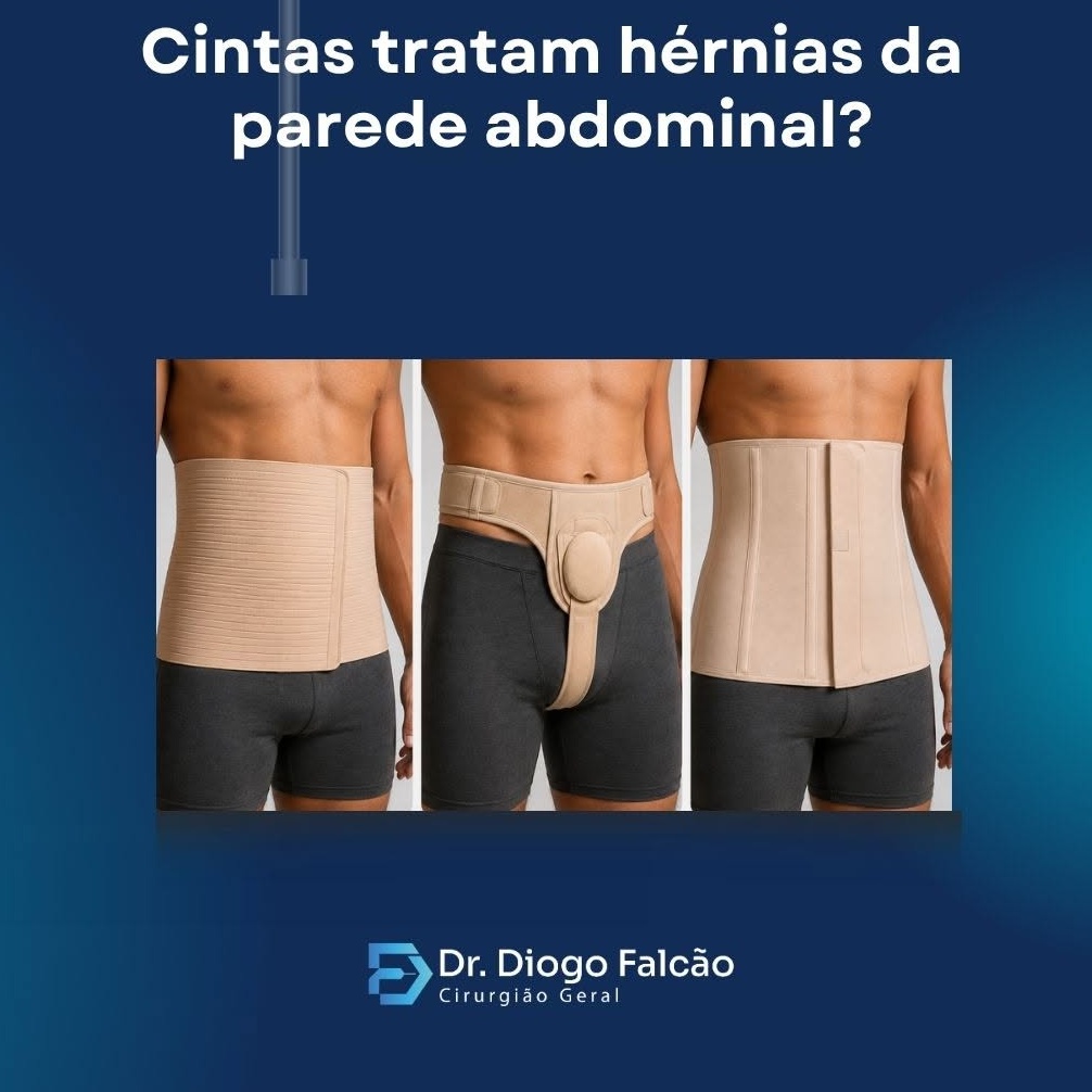 as cintas tratam as hernias da parede abdominal