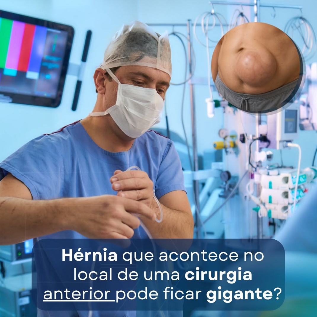 hernia incisional gigante tratamento complexo cirurgião experiente